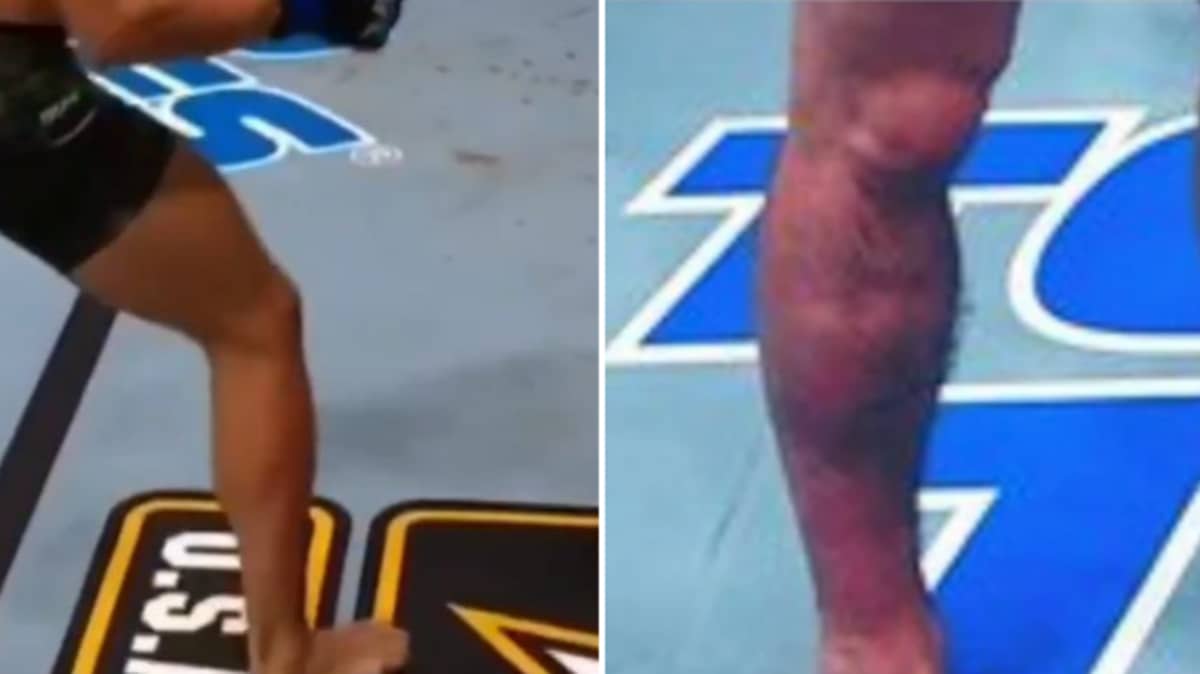 Dustin Poirier S Leg Kicks Were So Deadly Conor Mcgregor S Leg Buckled Under The Pressure